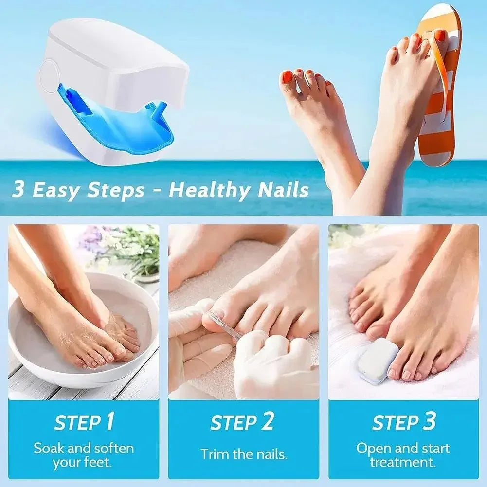 Rechargeable UV nail phototherapy instrument onychomycosis auxiliary tool UV nail phototherapy lamp cleaning lamp fungus lamp
