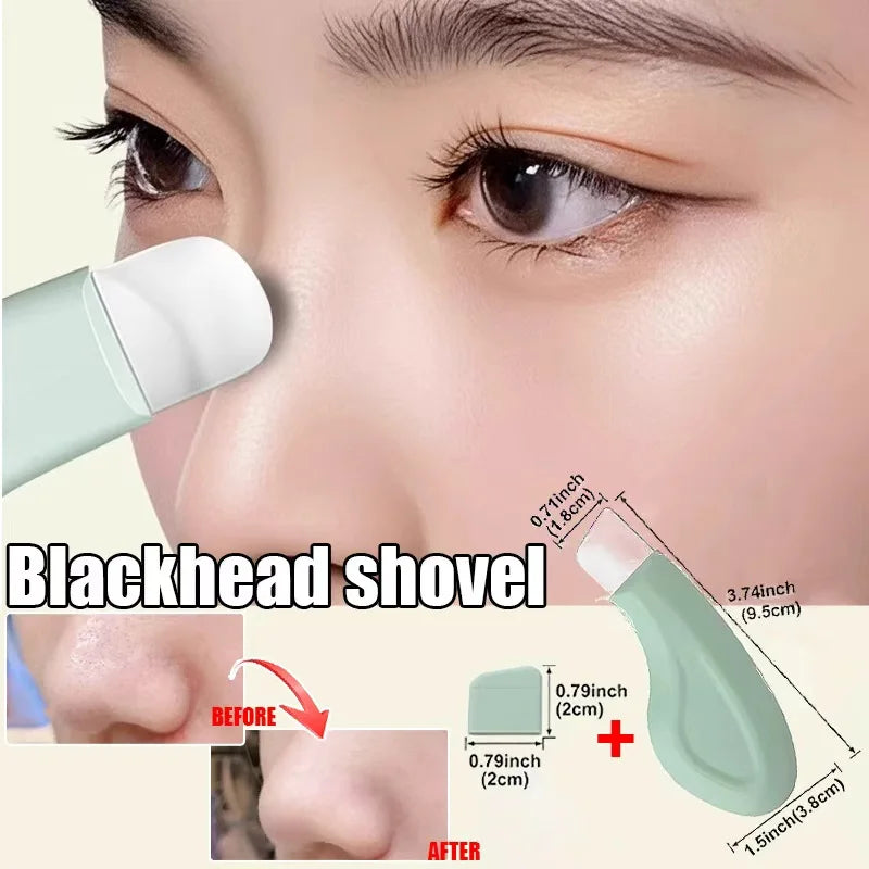 Blackhead and Whitehead Removal Tool for Nose and Face - Skin Pore Cleaner Skin Care Tools for Women