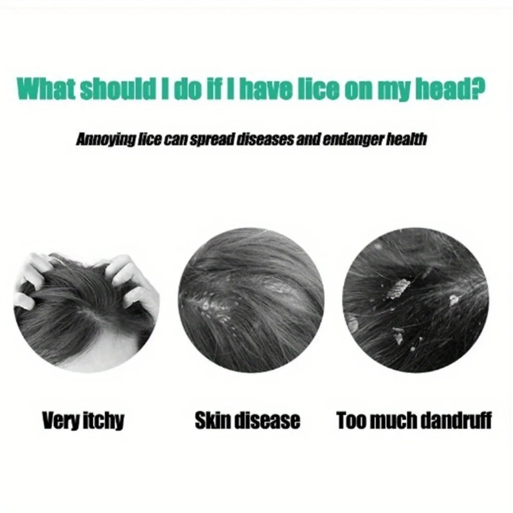 6Pcs/Set Lice Comb Easily Removes Eggs Lices Combs Dandruff Combs Long Lasting Non Deformation Lices Removal Head Lice Comb