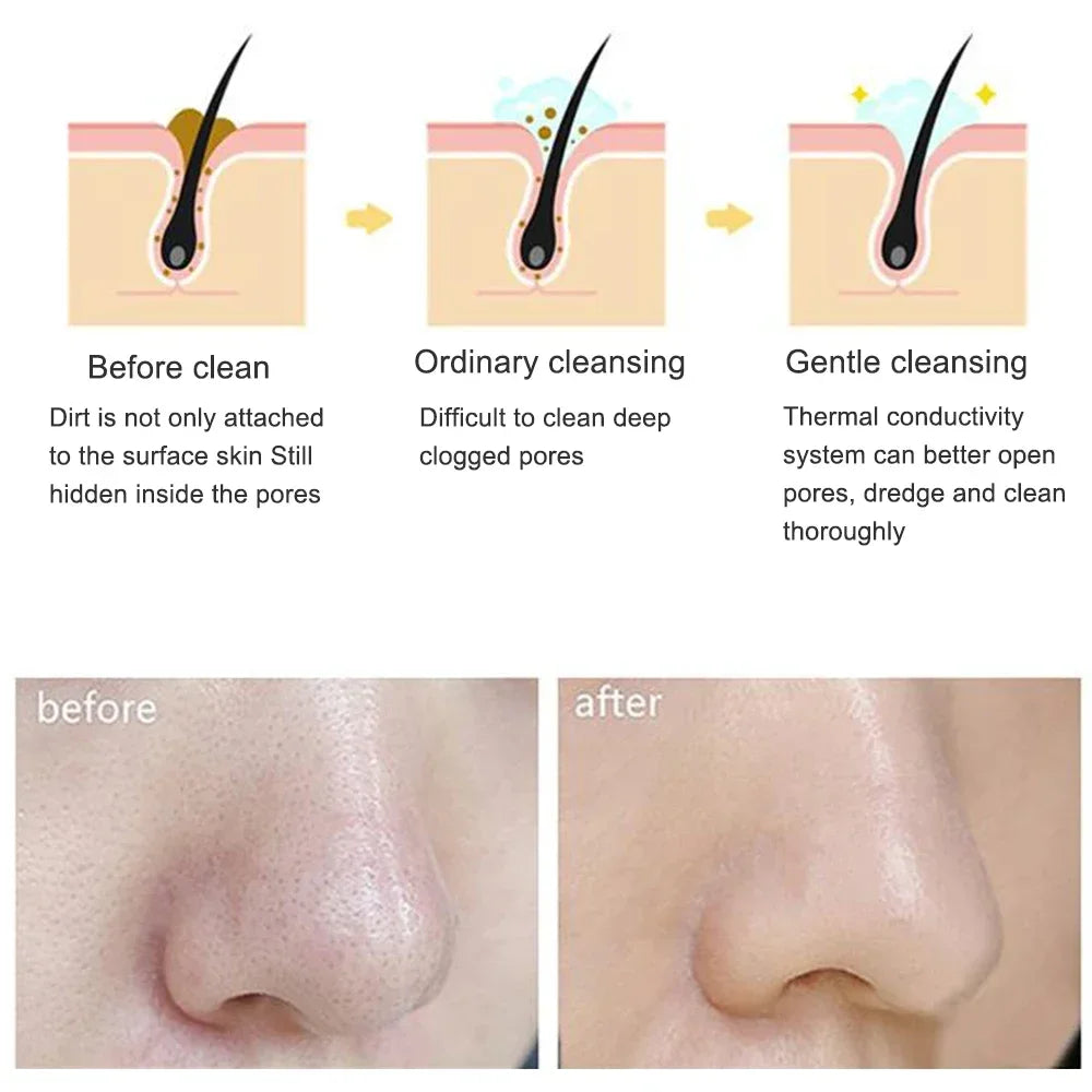 Electric Facial Cleansing Brush Face Skin Care Tools Waterproof Silicone Sonic Cleanser Facial