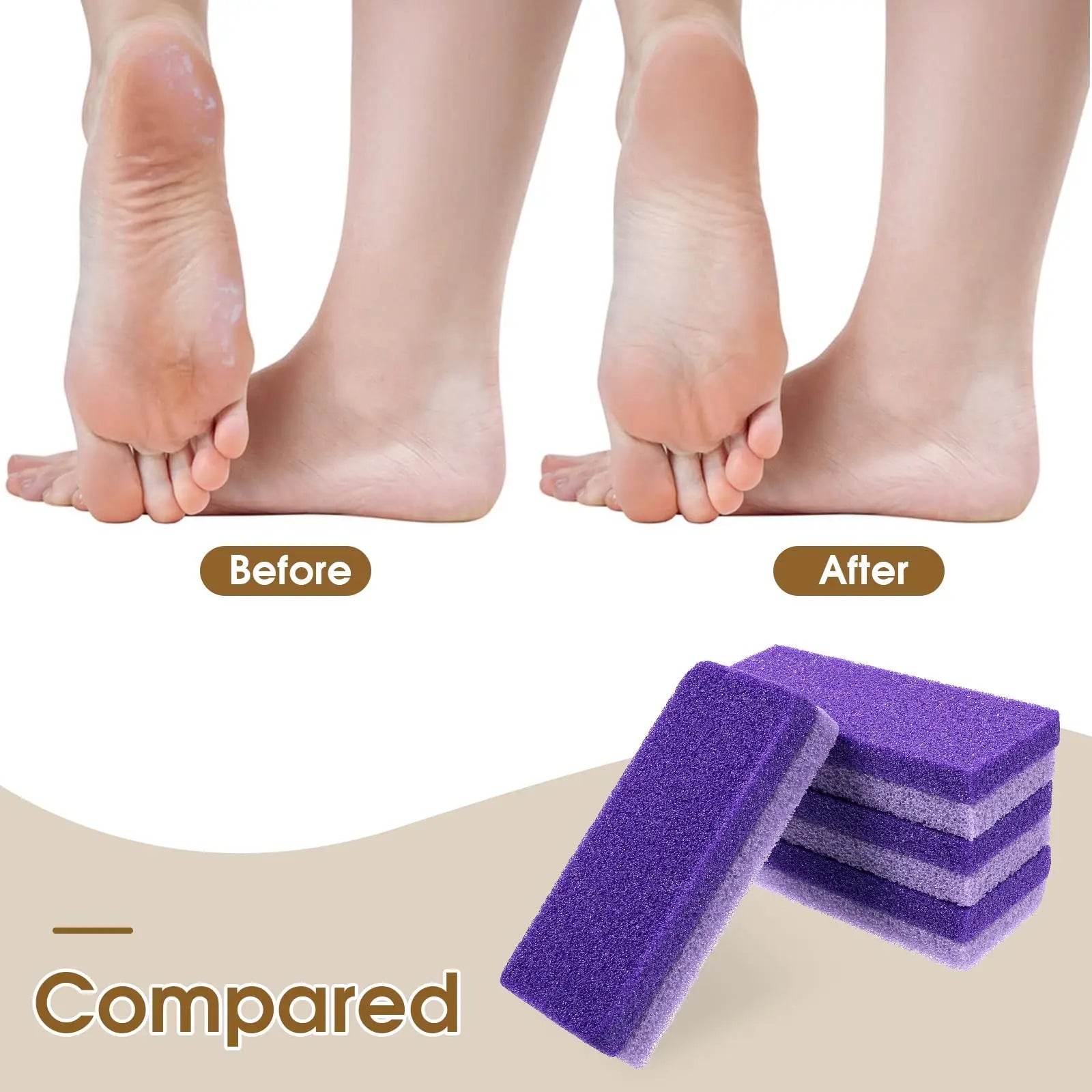 2-in-1 Pumice Stone And Foot Scrubber Callus Remover for Hard Skin Dead Skin Remover for Feet Heels Hands And Body