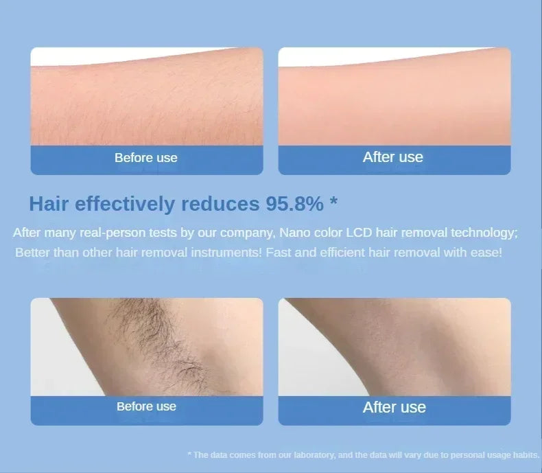 Painless Epilator Physical Crystal Hair Removal Body Depilation Tool Man Women's Hair Removal Beauty Tool Sanding Artifact